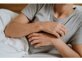 Bild von Hautausschlag durch Milben